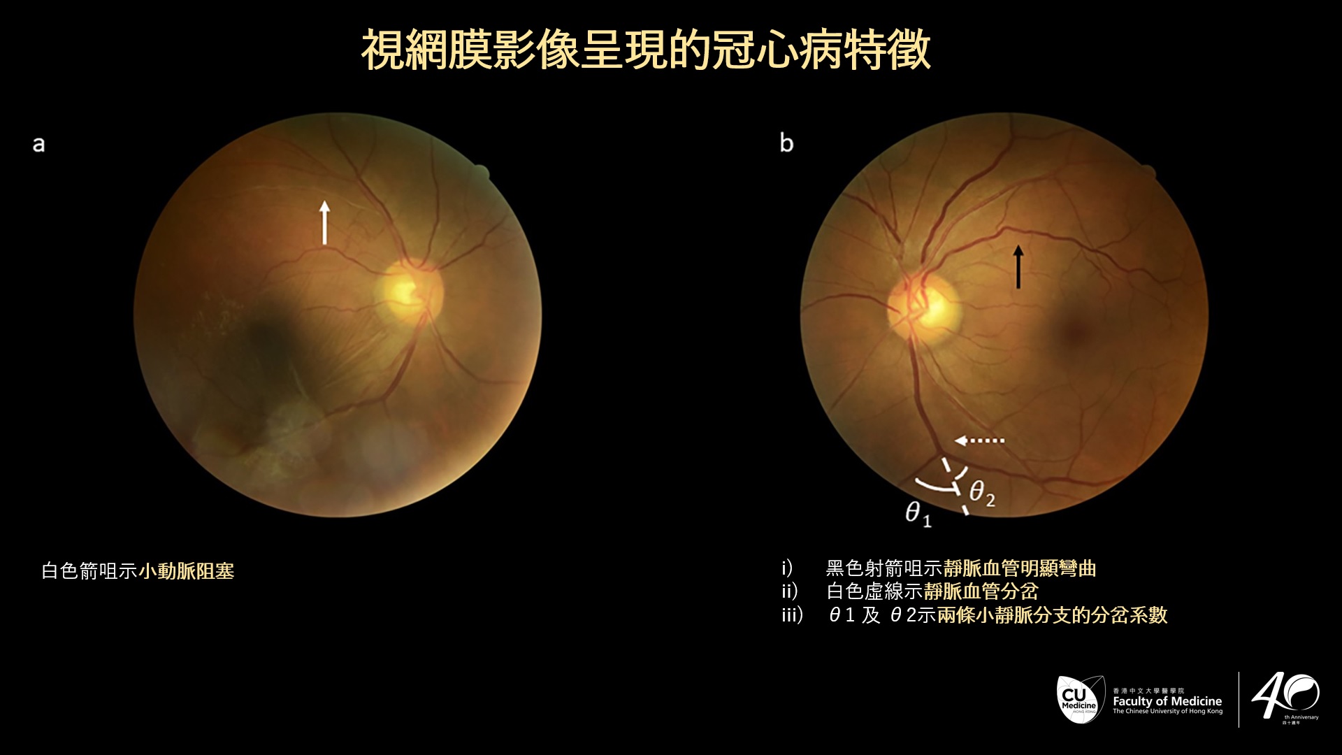 retinal images